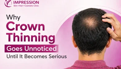 Crown Thinning Why You Don’t Notice It Until It’s Late