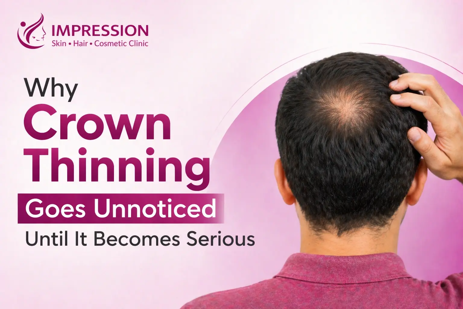 Crown Thinning Why You Don’t Notice It Until It’s Late