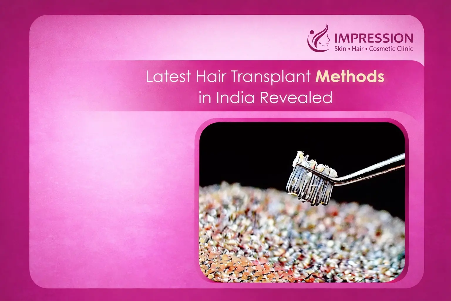 latest hair transplant technique in India wp