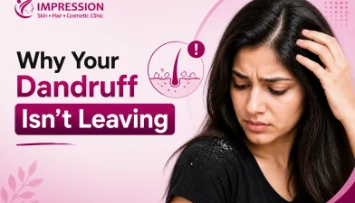 Dandruff That Won’t Go Away What It’s Trying to Tell You